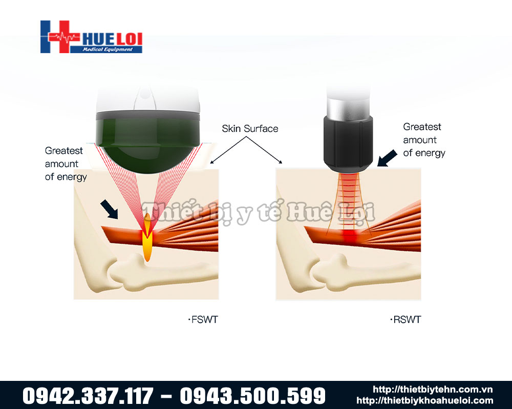 Nguyên lý Máy xung kích hội tụ EMFocus