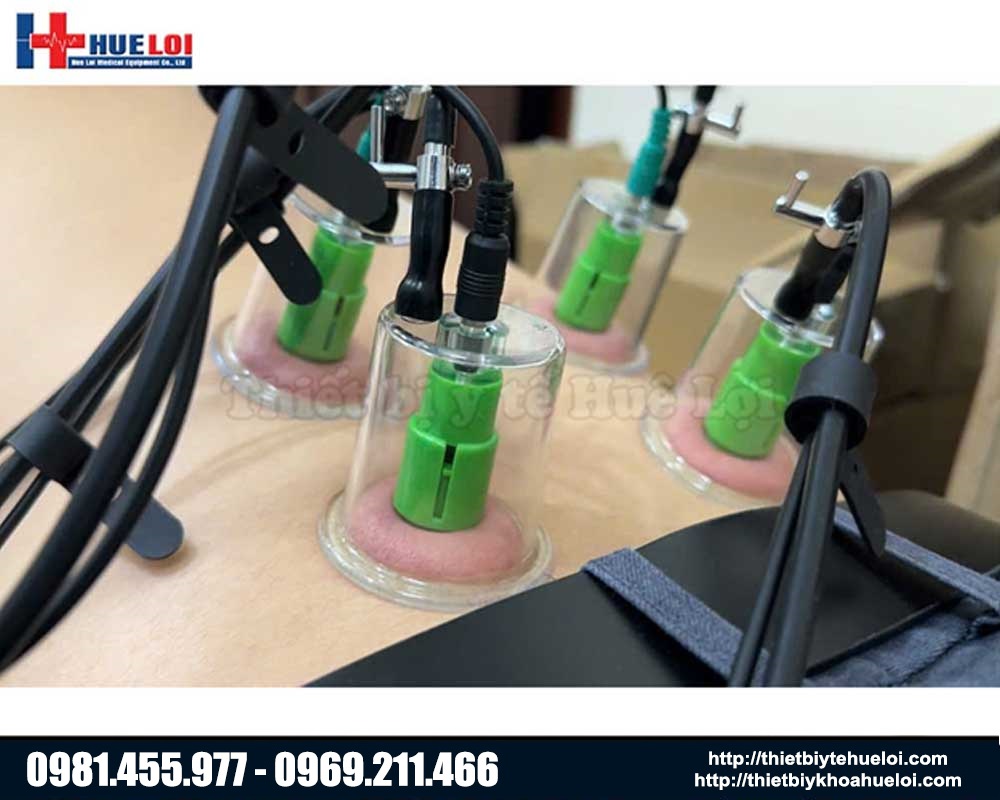 cốc châm cứu của máy điện châm giá rẻ