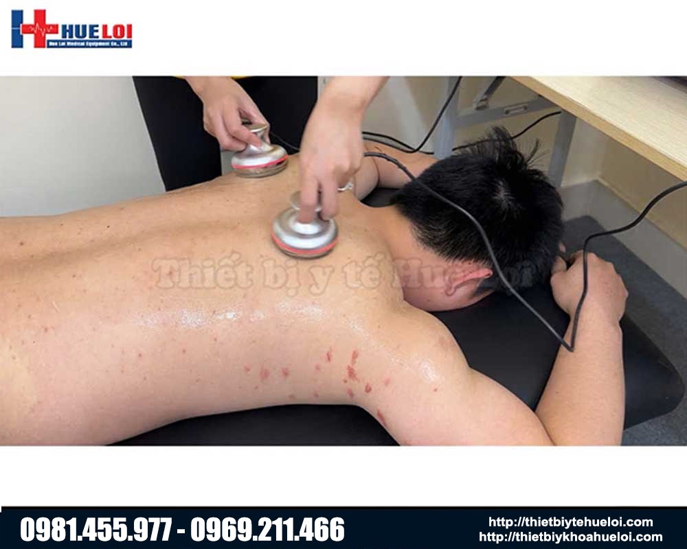 máy điện châm không kim kết hợp xung điện