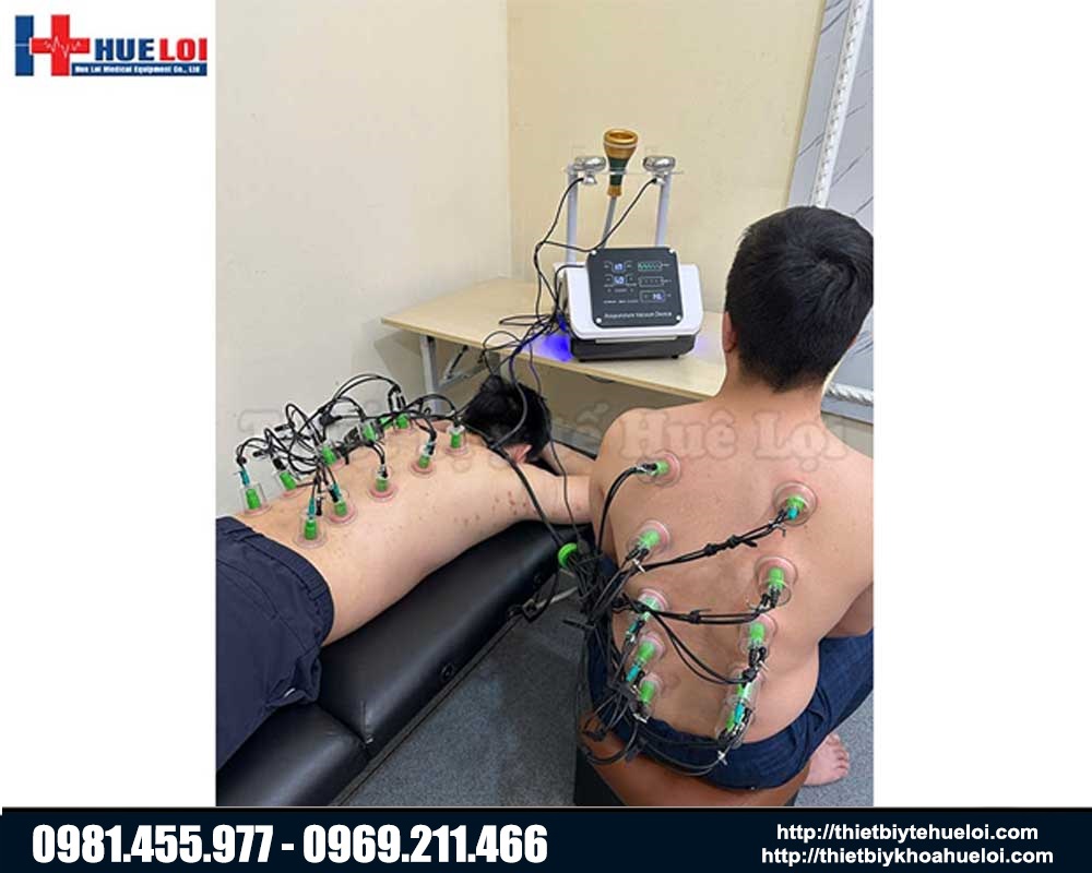 máy điện châm không kim có cốc hút và giác hút