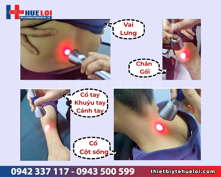 máy laser trị liệu đau xương khớp