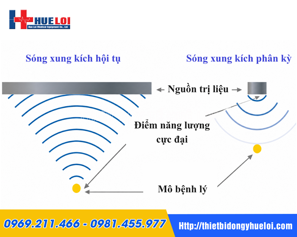 Cơ chế hoạt động s&oacute;ng xung k&iacute;ch hội tụ &aacute;p điện PIEZONIA so với s&oacute;ng ph&acirc;n kỳ