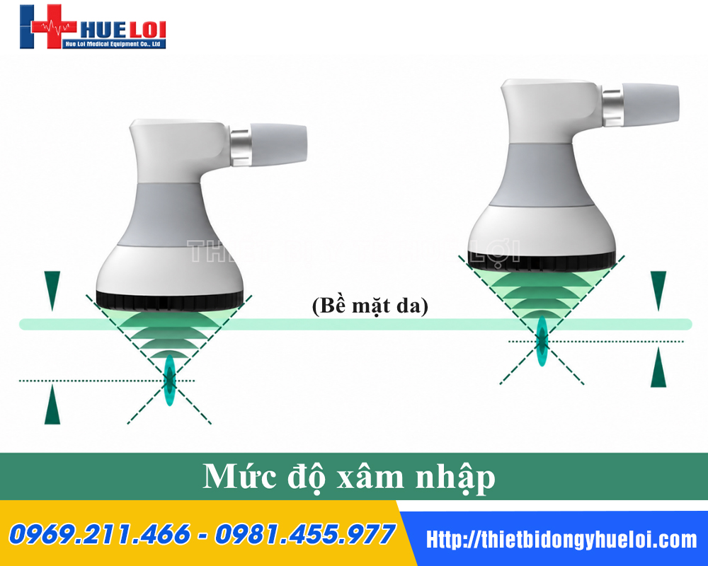 So s&aacute;nh độ s&acirc;u điều trị giữa c&aacute;c đầu ph&aacute;t s&oacute;ng của m&aacute;y PIEZONIA