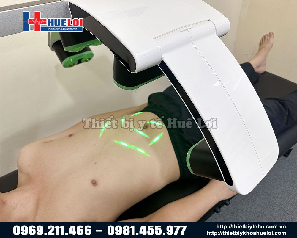 giảm mỡ bụng bằng máy laser