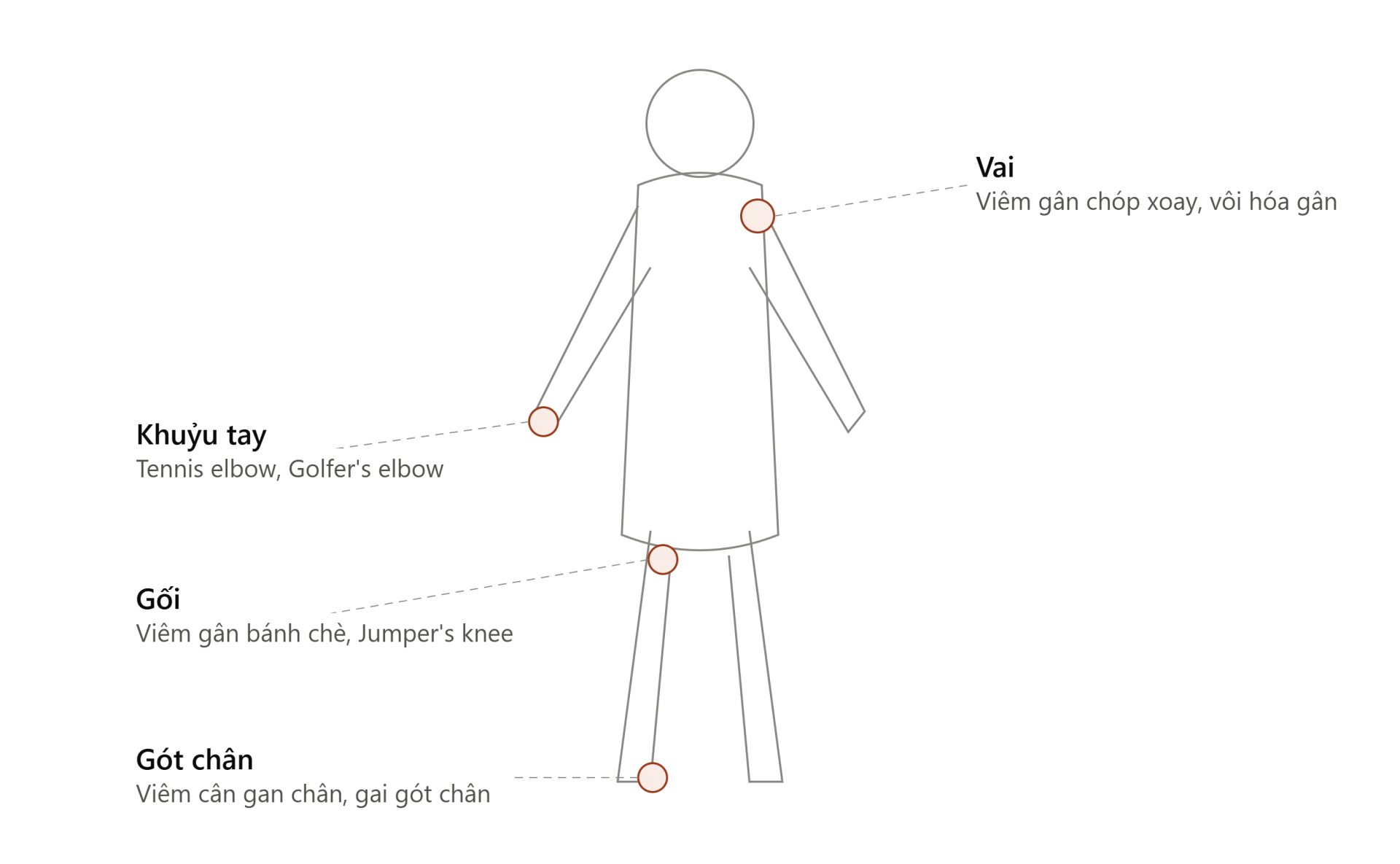 c&aacute;c vị tr&iacute; bệnh l&yacute; thường cần điều trị